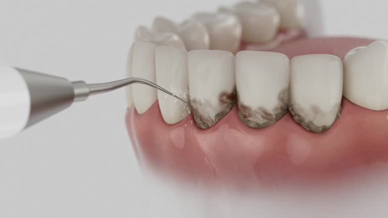 Trusted Teeth Cleaning And Checkup service in Waterloo, IA - Dentist Open Now